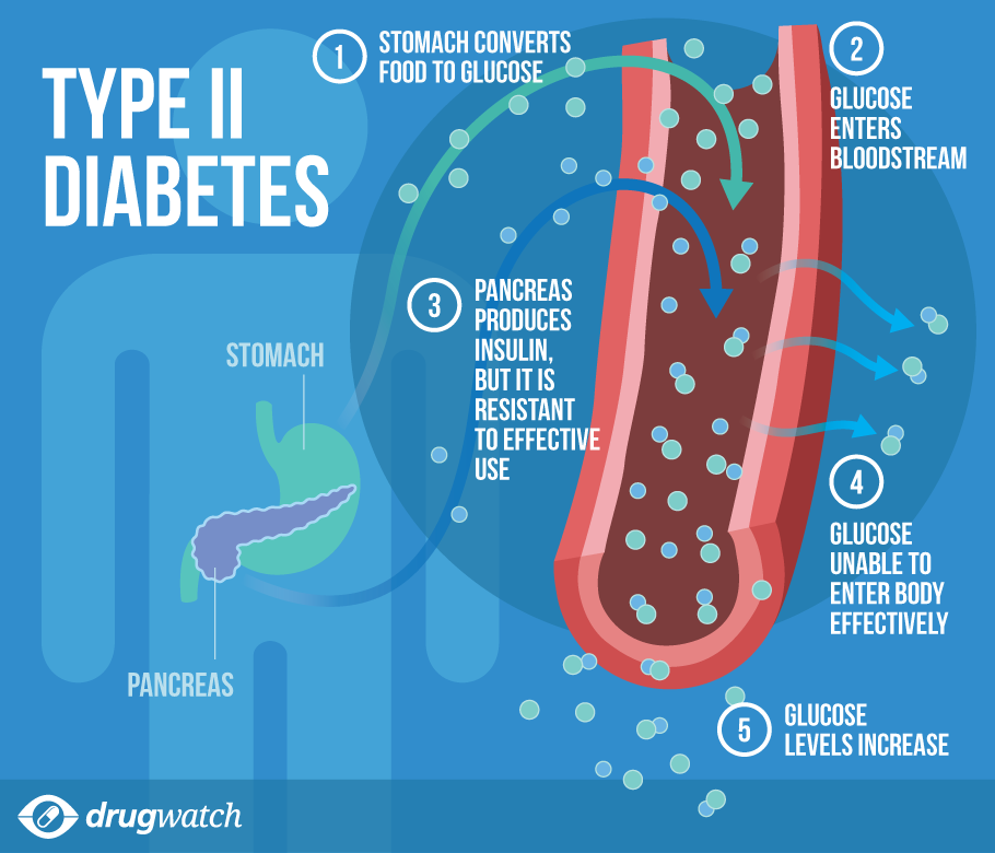 what is type 2 diabetes