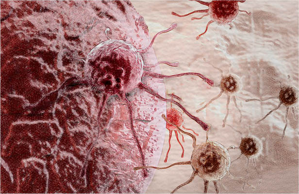 An artists impression of cancer cells