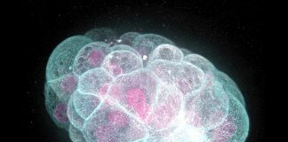 human colon cancer cells