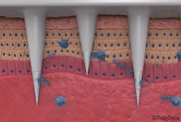 3d printed microneedles