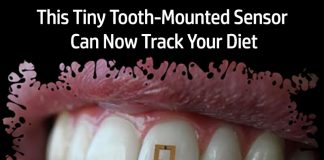 tiny tooth sensor for tracking diet